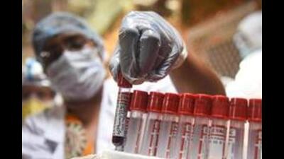 Officials noted that the state government has stopped the supply for Covishield and Corbevax vaccines. (HT FILE PHOTO) Officials noted that the state government has stopped the supply for Covishield and Corbevax vaccines. (HT FILE PHOTO)