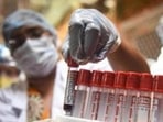 Private donors such as wealthy individuals and companies were responsible for close to 45% of medical donations in early 2020, the researchers found. (HT FILE PHOTO) Private donors such as wealthy individuals and companies were responsible for close to 45% of medical donations in early 2020, the researchers found. (HT FILE PHOTO)