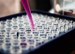 Patients with type 2 diabetes experience increased cancer diagnoses: Study(Unsplash) Patients with type 2 diabetes experience increased cancer diagnoses: Study(Unsplash)