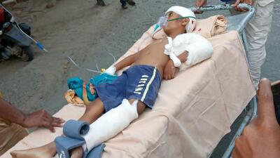 The child suffered severe head injuries and was rushed to the Murshidabad Medical College and Hospital. (PTI)