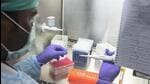 Private laboratories have been mushrooming in Punjab in the absence of a comprehensive framework to regulate diagnostic centres in the state. (Image for representational purpose) Private laboratories have been mushrooming in Punjab in the absence of a comprehensive framework to regulate diagnostic centres in the state. (Image for representational purpose)