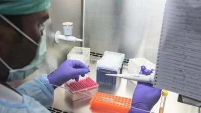 Private laboratories have been mushrooming in Punjab in the absence of a comprehensive framework to regulate diagnostic centres in the state. (Image for representational purpose) Private laboratories have been mushrooming in Punjab in the absence of a comprehensive framework to regulate diagnostic centres in the state. (Image for representational purpose)