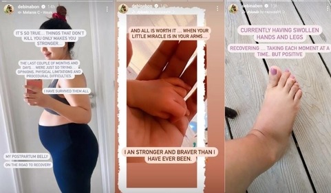 Debina Bonnerjee shared picture of her postpartum journey on Instagram Stories. Debina Bonnerjee shared picture of her postpartum journey on Instagram Stories.