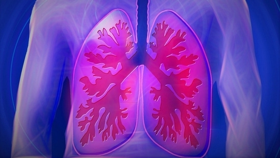 Lung transplant for COPD patients: Patients eligible, deciding factor, benefits (Image by kalhh from Pixabay )