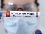 Monkeypox: Swab samples for monkeypox being tested. Monkeypox: Swab samples for monkeypox being tested.