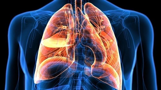 Lung cancer is the uncontrolled growth of abnormal cells that start off in one or both lungs.(Shutterstock)