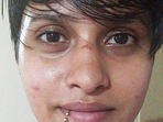 A photo of Shraddha Walkar allegedly after she was assaulted by Aaftab Poonawalla in 2020. (PTI)(HT_PRINT) A photo of Shraddha Walkar allegedly after she was assaulted by Aaftab Poonawalla in 2020. (PTI)(HT_PRINT)