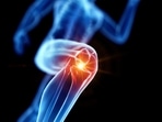 Once thought as the only route to fix full ACL ruptures, surgery may no longer be the only way. A new study suggests that no surgical intervention may be needed for some, but it's still a 50/50 gamble. And the biggest player is not the ortho or the physio, it's the patient. Here's why. (Shutterstock) Once thought as the only route to fix full ACL ruptures, surgery may no longer be the only way. A new study suggests that no surgical intervention may be needed for some, but it's still a 50/50 gamble. And the biggest player is not the ortho or the physio, it's the patient. Here's why. (Shutterstock)