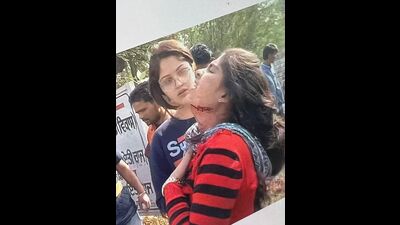 The fall on the barbed wire left Geetika with a throat injury, while Vani was also hurt. Both were rushed to a private hospital, where they remain under treatment. (HT Photo)