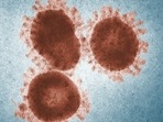 Scientists have revived 48,500 yrs old Zombie Virus trapped in ice.(Representational image/CDC) Scientists have revived 48,500 yrs old Zombie Virus trapped in ice.(Representational image/CDC)