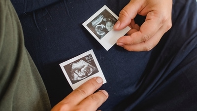 IVF: Dos and don’ts after embryo transfer (Amina Filkins)