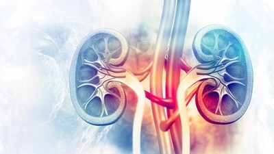 Lalu Prasad Yadav undergoes kidney transplant in Singapore. Here are diet plans for kidney patients (HT_PRINT) Lalu Prasad Yadav undergoes kidney transplant in Singapore. Here are diet plans for kidney patients (HT_PRINT)