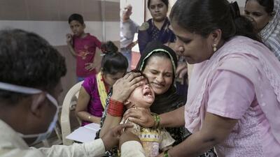 Mumbai: A healthcare worker administers a vaccine to a child following a measles outbreak, at a temporary vaccination camp in Mumbai, Monday, Dec. 5, 2022. (PTI Photo/Shashank Parade)(PTI12_05_2022_000144A) (PTI) Mumbai: A healthcare worker administers a vaccine to a child following a measles outbreak, at a temporary vaccination camp in Mumbai, Monday, Dec. 5, 2022. (PTI Photo/Shashank Parade)(PTI12_05_2022_000144A) (PTI)