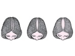 Female pattern baldness: Types, causes and treatment Female pattern baldness: Types, causes and treatment
