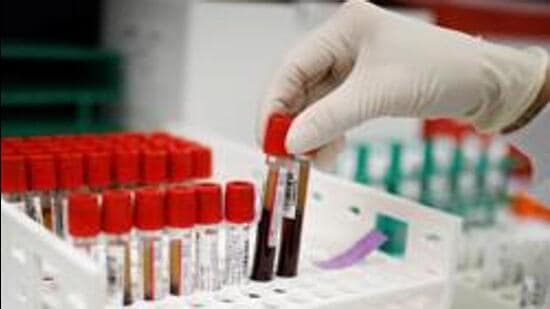 A health worker takes test tubes with plasma and blood samples after a separation process in a centrifuge during a coronavirus disease (COVID-19) vaccination study at the Research Centers of America, in Hollywood, Florida, U.S., September 24, 2020. REUTERS/Marco Bello (REUTERS)