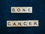 Bone cancer: Symptoms, diagnosis and treatment (Anna Tarazevich) Bone cancer: Symptoms, diagnosis and treatment (Anna Tarazevich)