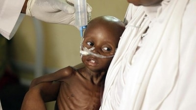 Starvation causes cell remodelling: Research (AP) Starvation causes cell remodelling: Research (AP)