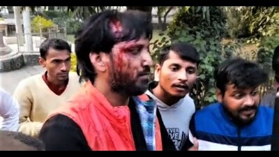 A former student leader injured after allegedly being assaulted by AU guards on Monday. (HT Photo) A former student leader injured after allegedly being assaulted by AU guards on Monday. (HT Photo)
