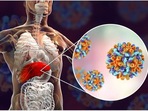 Understanding Viral Hepatitis A infection, tips to prevent it especially in kids (Twitter/Journalofclin12) Understanding Viral Hepatitis A infection, tips to prevent it especially in kids (Twitter/Journalofclin12)