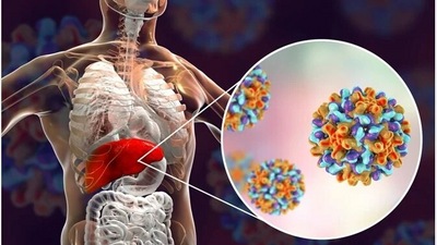 Understanding Viral Hepatitis A infection, tips to prevent it especially in kids (Twitter/Journalofclin12) Understanding Viral Hepatitis A infection, tips to prevent it especially in kids (Twitter/Journalofclin12)