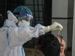 Covid cases are seeing a recent spike. Representative Image