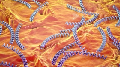 Syphilis is caused by the bacteria treponema pallidum (Imago/Science Photo Library ) Syphilis is caused by the bacteria treponema pallidum (Imago/Science Photo Library )