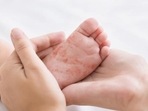 Mumbai's civic body said 36 children with symptoms of measles were admitted to hospitals during the day. (File) Mumbai's civic body said 36 children with symptoms of measles were admitted to hospitals during the day. (File)
