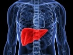 Fatty liver disease adversely affects brain health: Study(Twitter/AHealthyBod) Fatty liver disease adversely affects brain health: Study(Twitter/AHealthyBod)