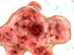 Brain-eating amoeba, naegleria fowleri is an amoeba (a single-celled living organism) that can cause infections in the brain. (source: CDC)