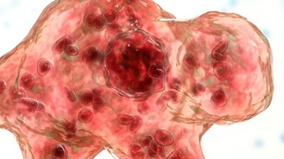 Brain-eating amoeba, naegleria fowleri is an amoeba (a single-celled living organism) that can cause infections in the brain. (source: CDC)