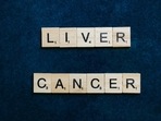 Liver cancer begins in the cells of your liver. It may be primary or secondary liver cancer.(Pixabay) Liver cancer begins in the cells of your liver. It may be primary or secondary liver cancer.(Pixabay)