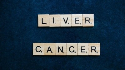 Liver cancer begins in the cells of your liver. It may be primary or secondary liver cancer. (Pixabay) Liver cancer begins in the cells of your liver. It may be primary or secondary liver cancer. (Pixabay)