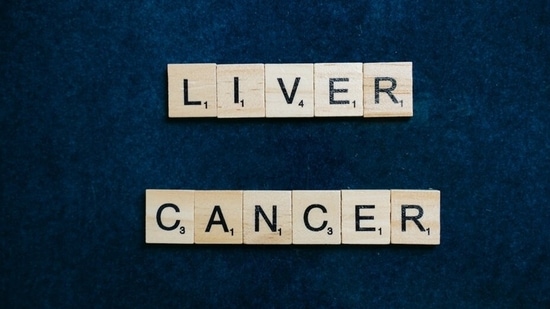 Liver cancer begins in the cells of your liver. It may be primary or secondary liver cancer.