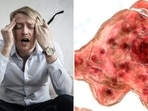 Brain-Eating Amoeba kills South Korean man; know all about deadly infection(Pexels) Brain-Eating Amoeba kills South Korean man; know all about deadly infection(Pexels)