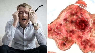 Brain-Eating Amoeba kills South Korean man; know all about deadly infection (Pexels) Brain-Eating Amoeba kills South Korean man; know all about deadly infection (Pexels)