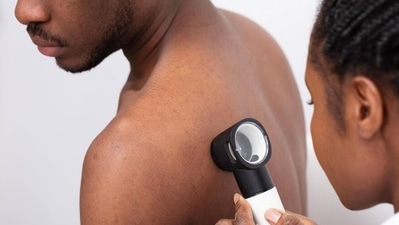 Skin cancers are rare in Africa and Asia, but data suggest African countries could see a 96% increase in new cases in the next 20 years. (Andrey Popov/Panthermedia/IMAGO) Skin cancers are rare in Africa and Asia, but data suggest African countries could see a 96% increase in new cases in the next 20 years. (Andrey Popov/Panthermedia/IMAGO)