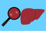 End-stage liver disease: Symptoms and everything else you need to know (Image by Mohamed Hassan from Pixabay ) End-stage liver disease: Symptoms and everything else you need to know (Image by Mohamed Hassan from Pixabay )