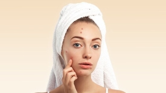 Skin Allergies: When the liver fails to flush out the toxins from our body, the body tries to do liver's work with the help of the skin. Acne, eczema, skin rashes, boils, etc., are all result of the skin trying to eject the toxins from the body.(freepik)