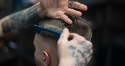 Hair transplant: Myths, facts and guidelines (Dmitry Zvolskiy) Hair transplant: Myths, facts and guidelines (Dmitry Zvolskiy)