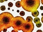 Antibiotic resistance happens when bugs become immune to existing drugs, like antibiotics, antivirals or antifungals, rendering minor injuries and common infections potentially deadly.(Shutterstock/HT Archive) Antibiotic resistance happens when bugs become immune to existing drugs, like antibiotics, antivirals or antifungals, rendering minor injuries and common infections potentially deadly.(Shutterstock/HT Archive)