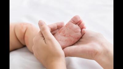 Haryana’s sex ratio at birth improves slightly in 2022 (Shutterstock) Haryana’s sex ratio at birth improves slightly in 2022 (Shutterstock)
