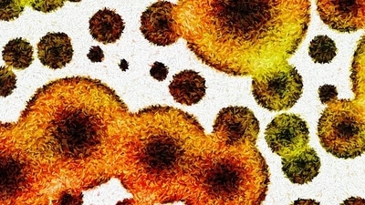 Antibiotic resistance happens when bugs become immune to existing drugs, like antibiotics, antivirals or antifungals, rendering minor injuries and common infections potentially deadly. (Shutterstock/HT Archive) Antibiotic resistance happens when bugs become immune to existing drugs, like antibiotics, antivirals or antifungals, rendering minor injuries and common infections potentially deadly. (Shutterstock/HT Archive)