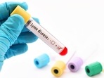 Lyme disease heightens risk of mental disorders, suicidality: Study