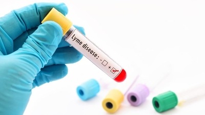 Lyme disease heightens risk of mental disorders, suicidality: Study (Shutterstock) Lyme disease heightens risk of mental disorders, suicidality: Study (Shutterstock)