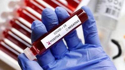 Dhanbad district surveillance officer Dr Rajkumar Singh said the test sample of the Covid positive student will be sent for genome sequencing (Representative Photo) Dhanbad district surveillance officer Dr Rajkumar Singh said the test sample of the Covid positive student will be sent for genome sequencing (Representative Photo)