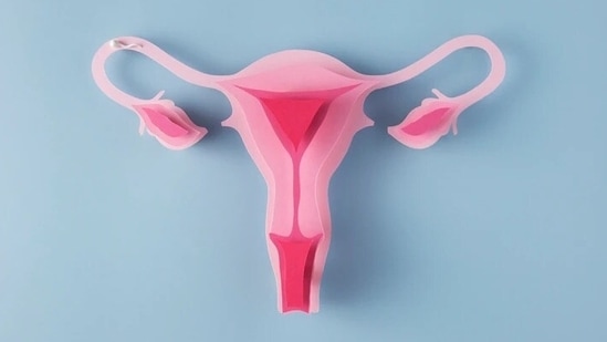 Everything You Need to Know About Ovarian Cysts: Causes, Diagnosis