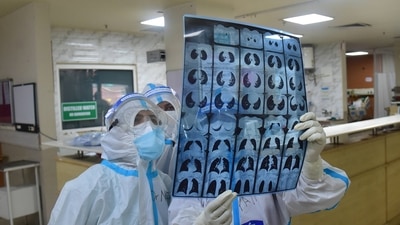 CT scan enables detection and cure of the commonest cause of high blood pressure (PTI Photo) CT scan enables detection and cure of the commonest cause of high blood pressure (PTI Photo)