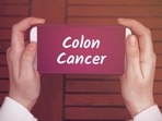 Chemotherapy before surgery cuts risk of colon cancer relapse: Study(Shutterstock) Chemotherapy before surgery cuts risk of colon cancer relapse: Study(Shutterstock)