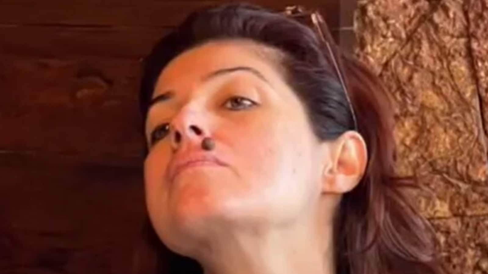 Twinkle Khanna shows the ‘mole’ above her lip, fans think it looks ‘bigger than her two nostrils combined’. See pic