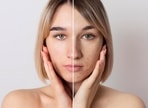 It is important to know the causes of your acne to take control and achieve clear, healthy skin. (freepik) It is important to know the causes of your acne to take control and achieve clear, healthy skin. (freepik)